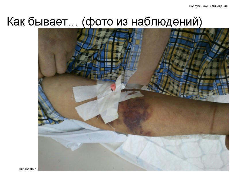 Как бывает… (фото из наблюдений) Собственные наблюдения